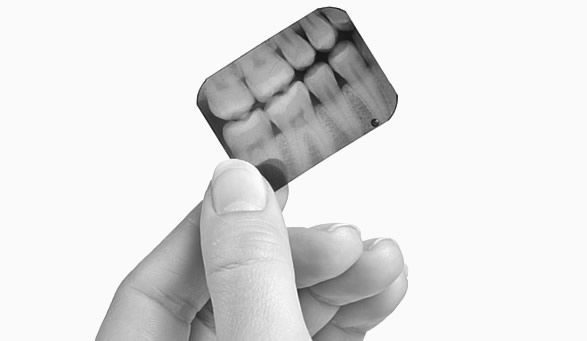 Dental Implants & Restorations