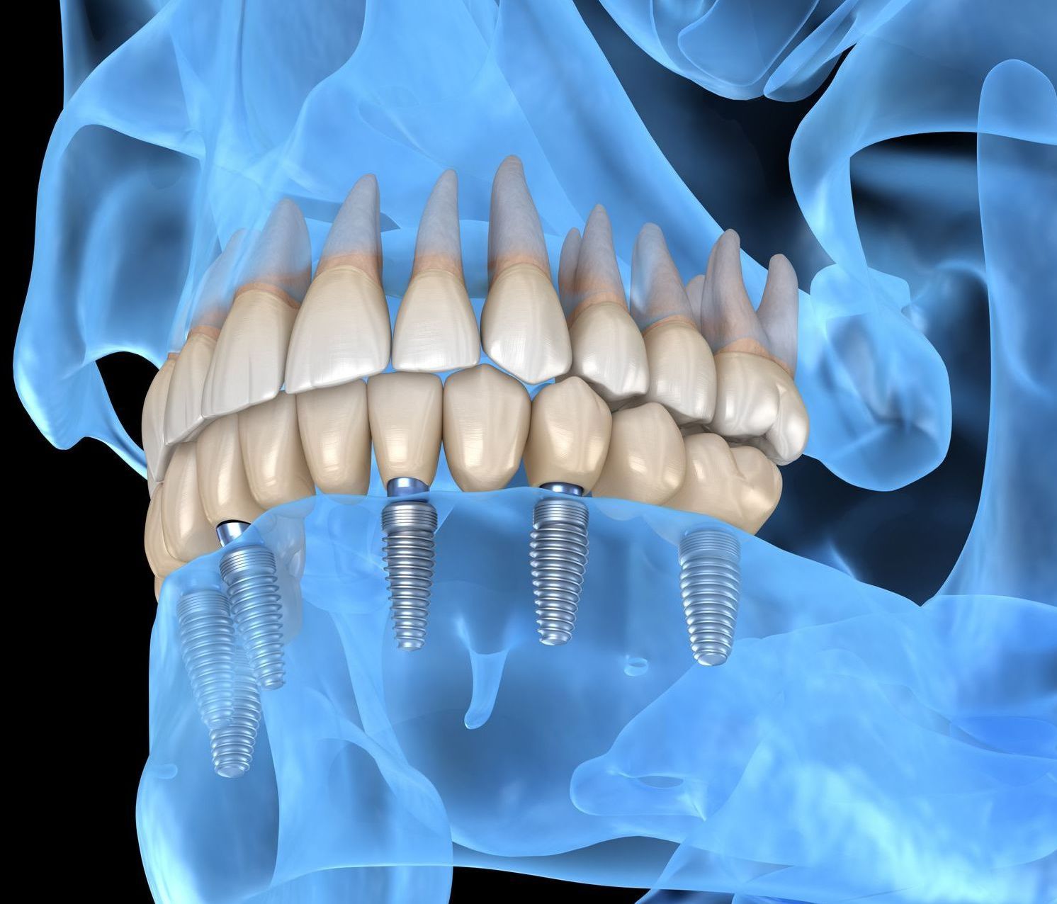 Dental Exams & PRSI Checkups